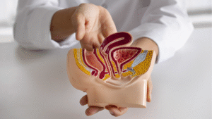 Pólipos Intestinais | Endostar