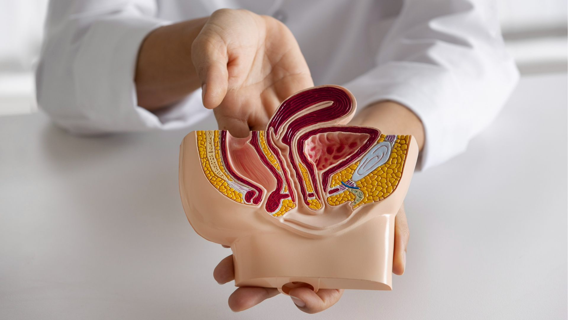 Pólipos Intestinais | Endostar