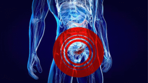 Sangramento Digestivo | Endostar